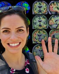 Photo of a woman in front of colorful brain scans